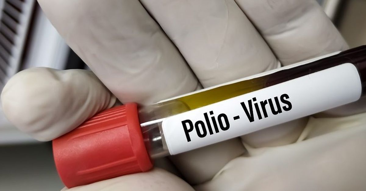 Vírus da poliomielite é encontrado no esgoto de Londres